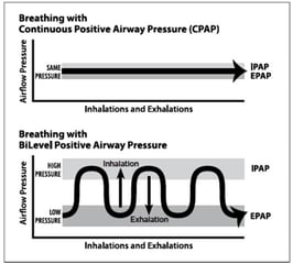 The ABCs of CPAP: the Gold Standard of Care for Sleep Apnea